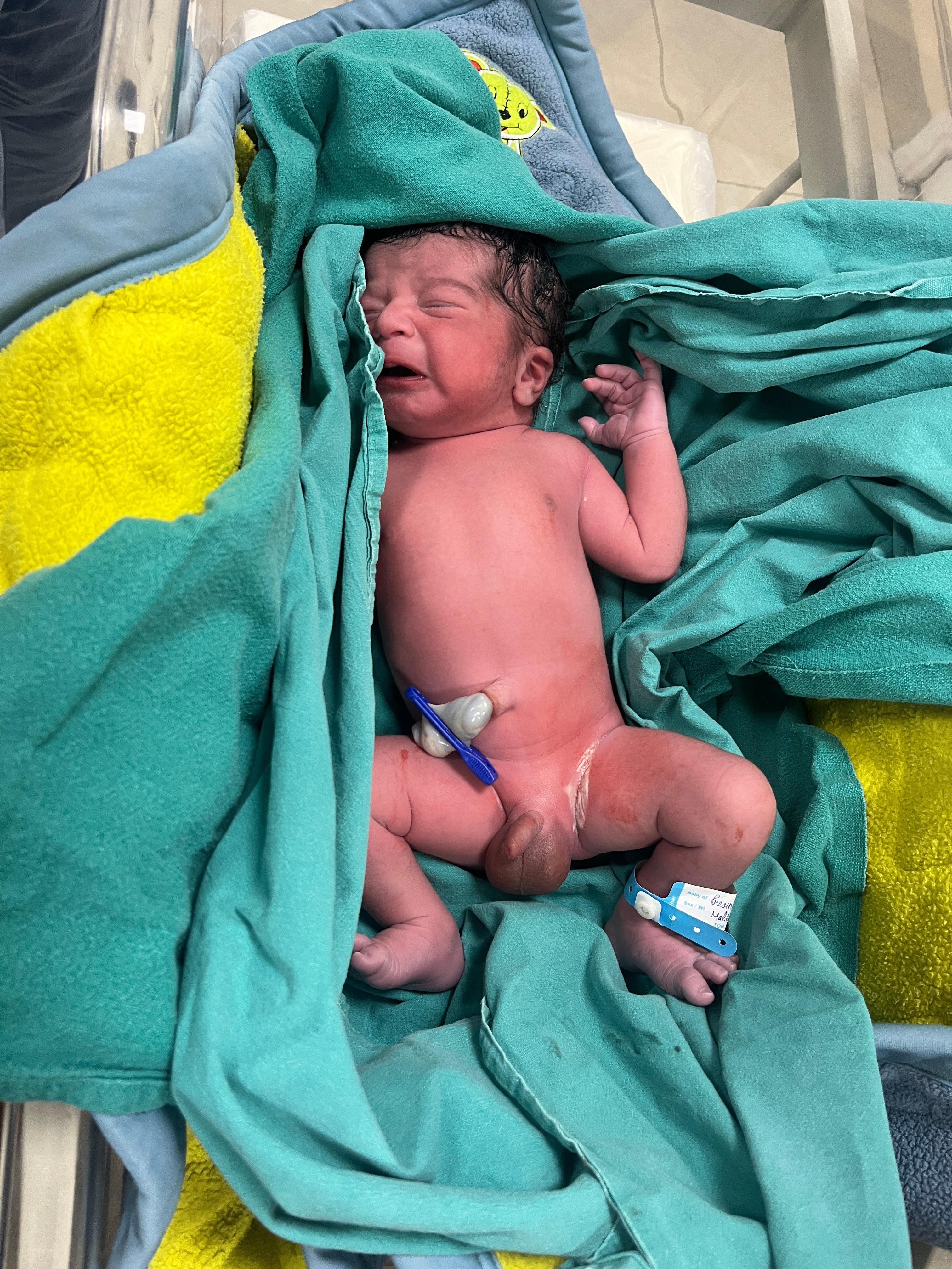 Newborn baby after delivery